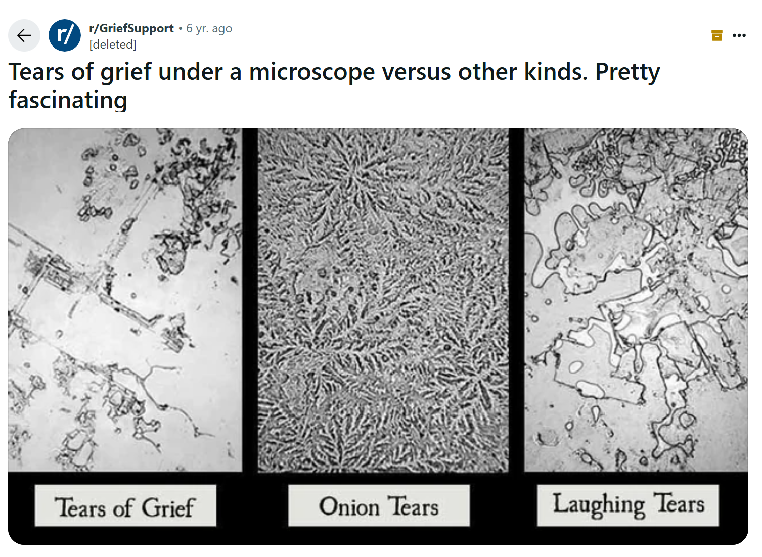 Tears as viewed from under a microscope, showing that tears of grief have straighter lines and more square shapes than tears from laughing or cutting onions.
